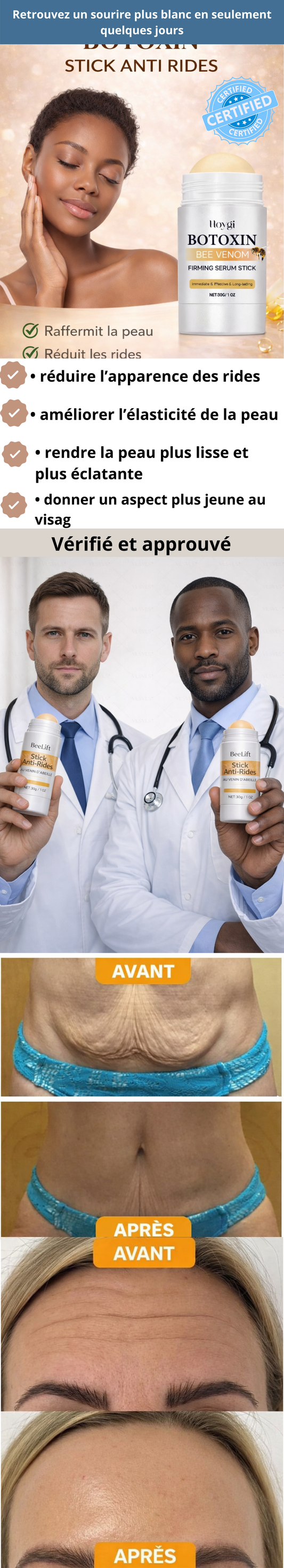 Botoxin – Stick Anti-Rides au Venin d’Abeille