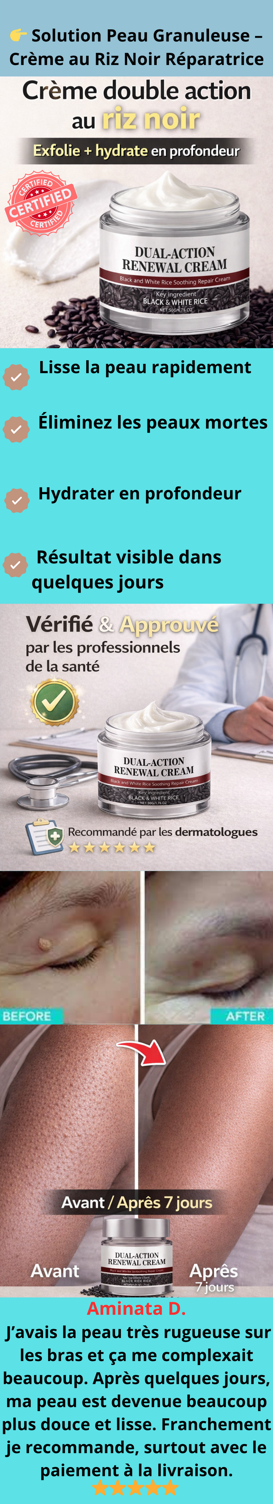 ✅ Crème Anti-Peau Rugueuse au Riz Noir – Lisse et Hydrate en 7 Jours